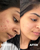 Moroccan Beauty Vitamin E Serum Multi-actions Acné, Cernes et Rides - 30ml